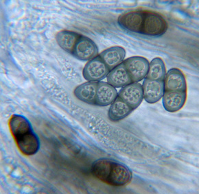 Spores bunes  1 cloison, 13-18 x 7-10 m